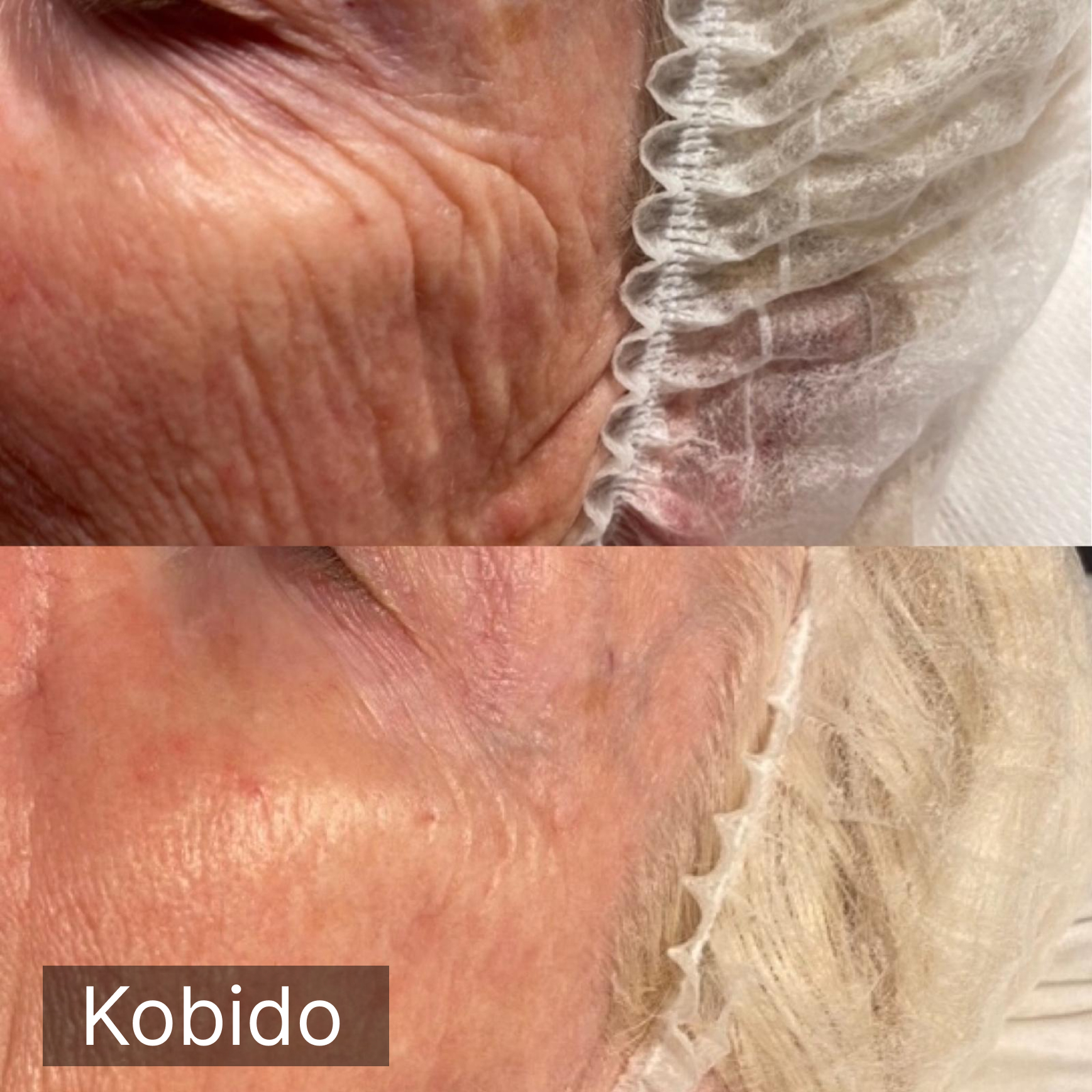 Modelage Kobido résultats